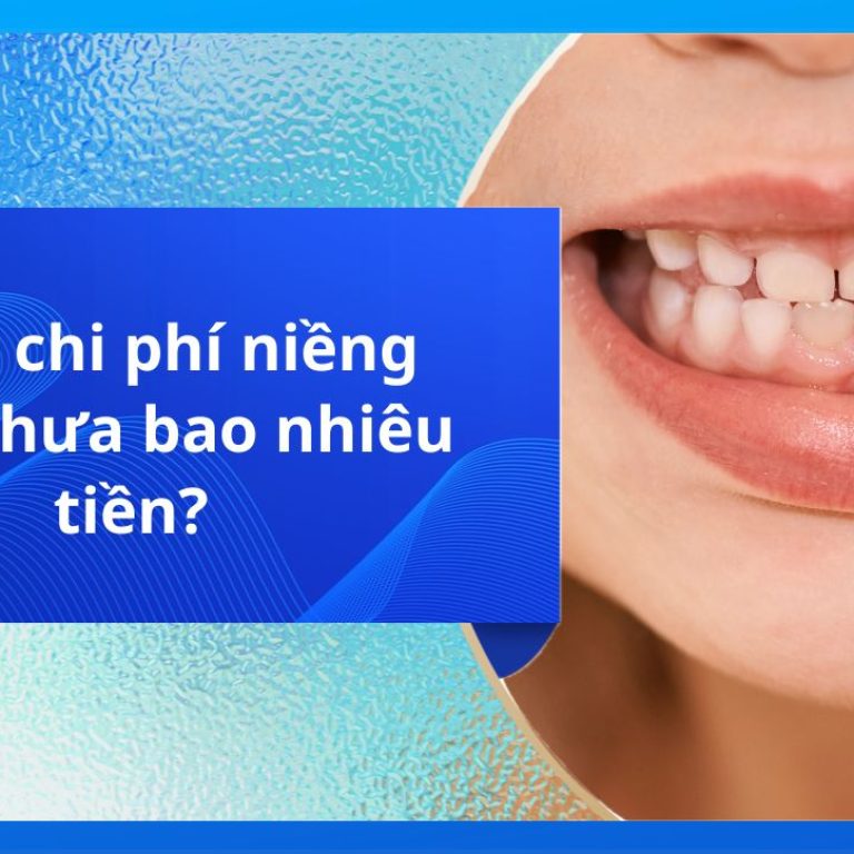 Tổng chi phí niềng răng thưa bao nhiêu tiền?