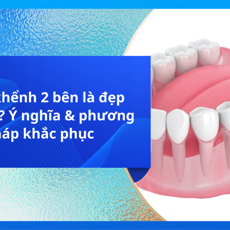 Răng khểnh 2 bên là đẹp hay xấu? Ý nghĩa & phương pháp khắc phục