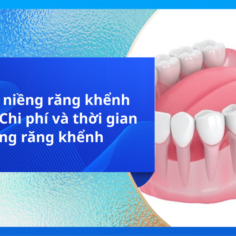 Có nên niềng răng khểnh không? Chi phí và thời gian niềng răng khểnh