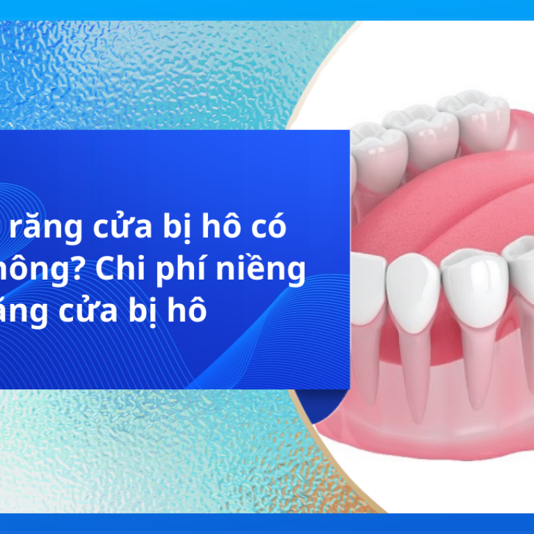 Niềng răng cửa bị hô có được không? Chi phí niềng răng cửa bị hô
