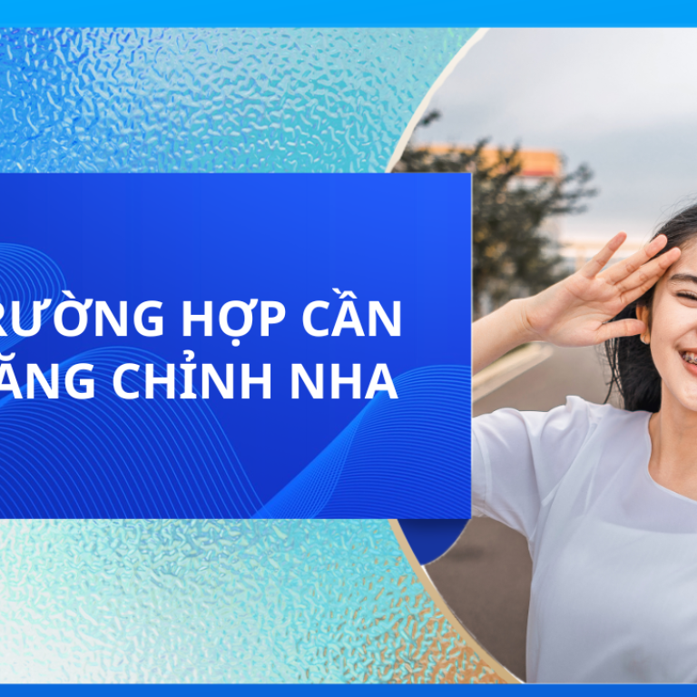 CÁC TRƯỜNG HỢP CẦN KÉO RĂNG CHỈNH NHA