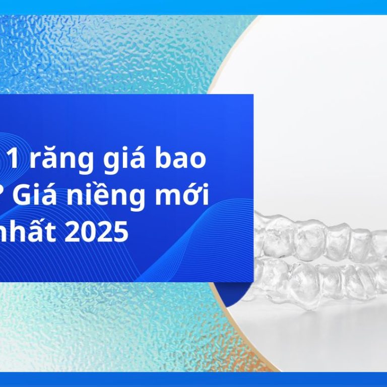 Niềng 1 răng giá bao nhiêu? Giá niềng mới nhất 2025
