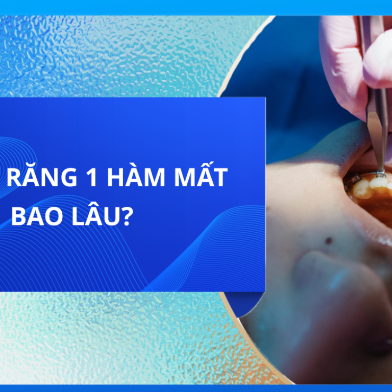NIỀNG RĂNG 1 HÀM MẤT BAO LÂU?