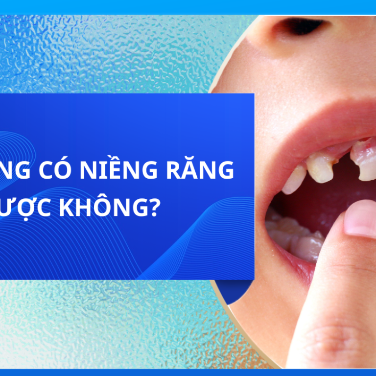 MẤT RĂNG CÓ NIỀNG RĂNG ĐƯỢC KHÔNG?