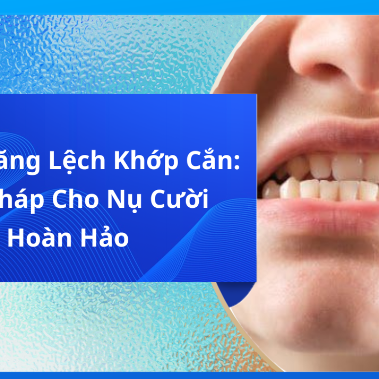 Niềng Răng Lệch Khớp Cắn: Giải Pháp Cho Nụ Cười Hoàn Hảo