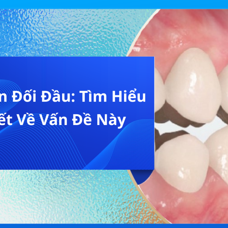 Khớp Cắn Đối Đầu: Tìm Hiểu Chi Tiết Về Vấn Đề Này