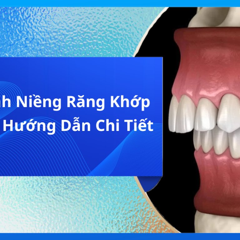 Quy Trình Niềng Răng Khớp Cắn Sâu: Hướng Dẫn Chi Tiết