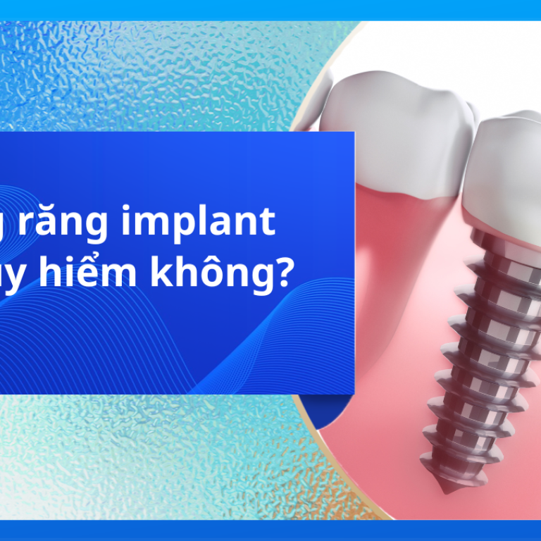 Trồng răng Implant có nguy hiểm không?