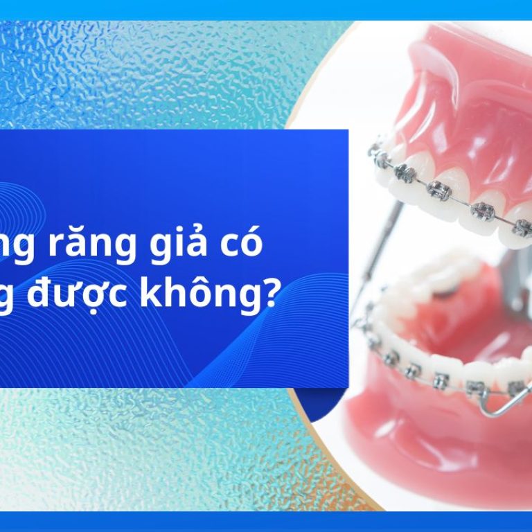Trồng răng giả có niềng được không?