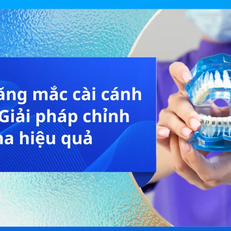 Niềng Răng Bằng Nhựa: Lựa Chọn Cho Nụ Cười Hoàn Hảo