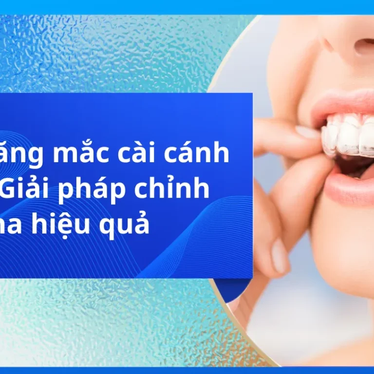 Niềng Răng Trong Suốt Invisalign: Giải Pháp Cho Nụ Cười Hoàn Hảo