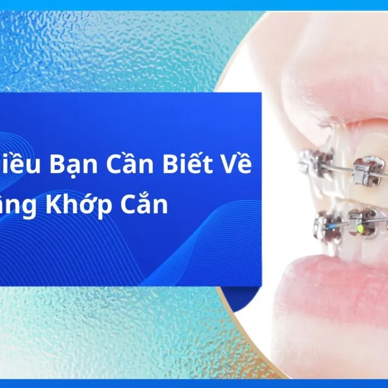Những Điều Bạn Cần Biết Về Nâng Khớp Cắn