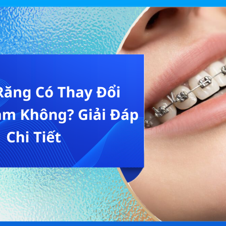 Niềng Răng Có Thay Đổi Xương Hàm Không? Giải Đáp Chi Tiết