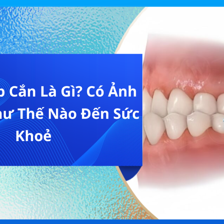 Lệch khớp cắn là gì? Tìm hiểu nguyên nhân