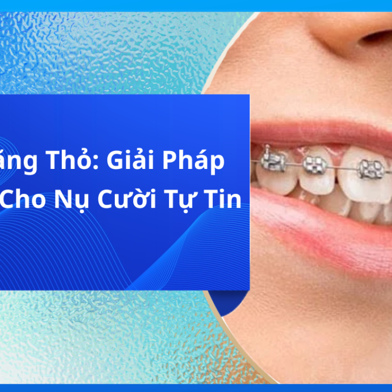 Niềng Răng Thỏ: Giải Pháp Hiệu Quả Cho Nụ Cười Tự Tin