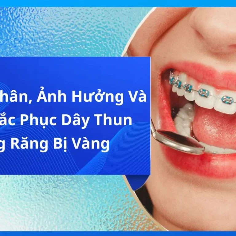 Nguyên Nhân, Ảnh Hưởng Và Cách Khắc Phục Dây Thun Niềng Răng Bị Vàng