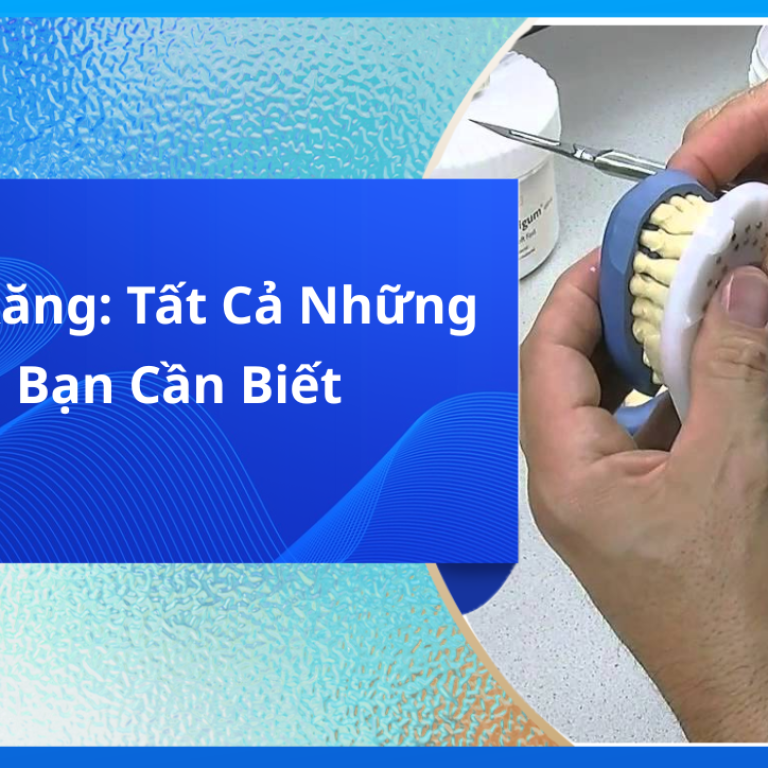 Lấy dấu răng: Tất cả những điều bạn cần biết