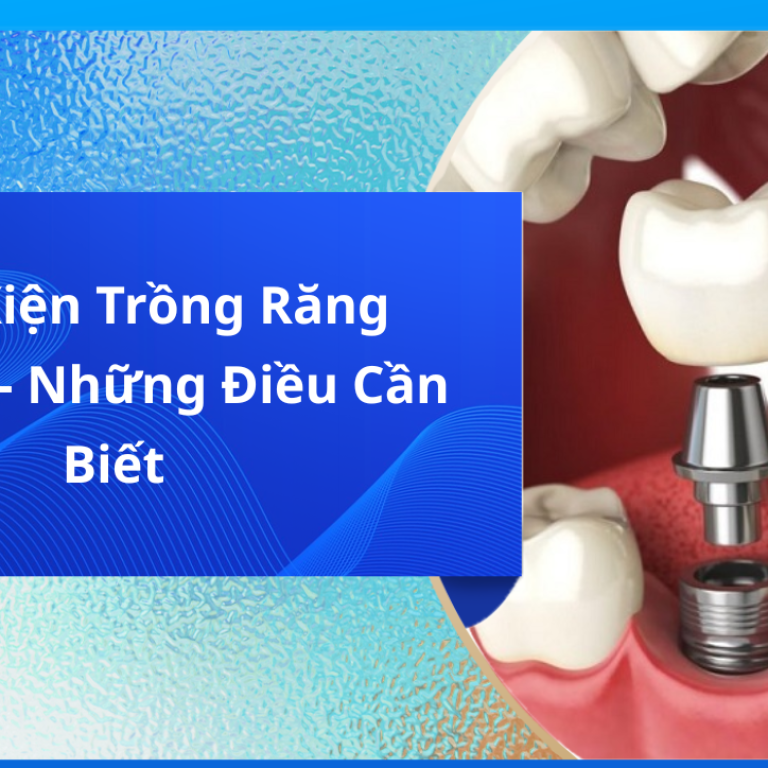 Điều kiện trồng răng implant