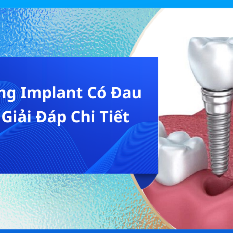 Trồng răng Implant có đau không?