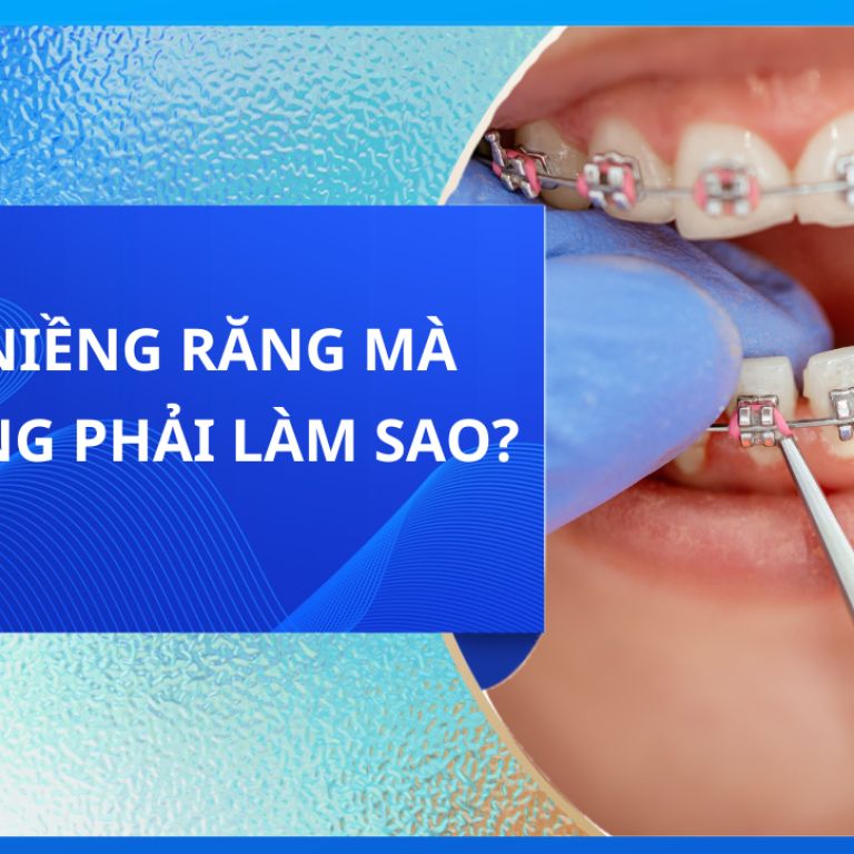 ĐANG NIỀNG RĂNG MÀ MỌC RĂNG PHẢI LÀM SAO?