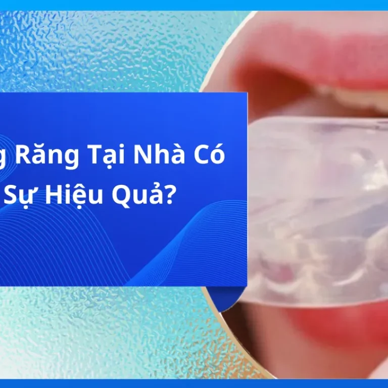 Bộ Niềng Răng Tại Nhà Có Thực Sự Hiệu Quả?