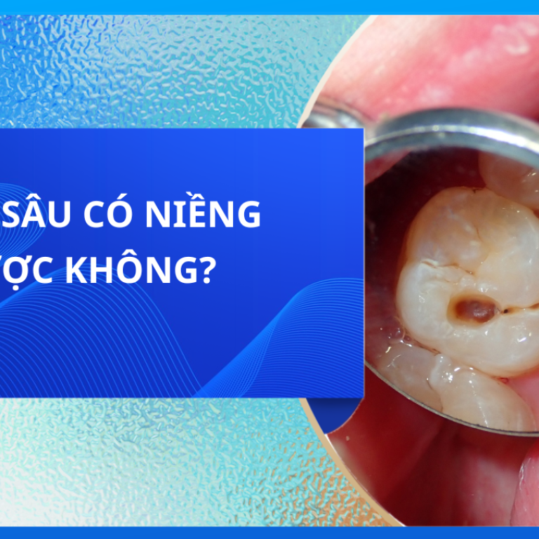 Răng sâu có niềng được không?