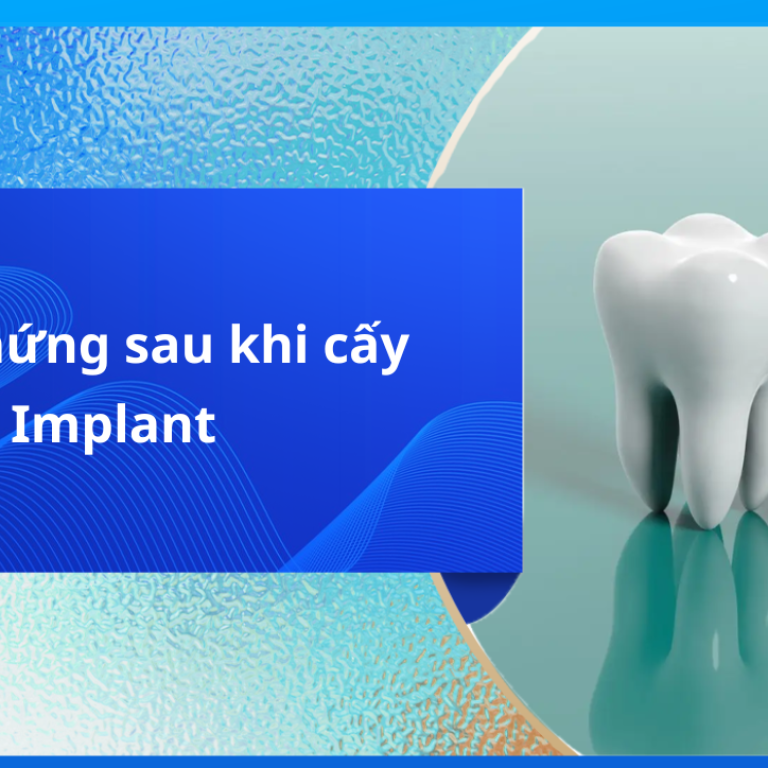 Biến chứng sau khi cấy implant