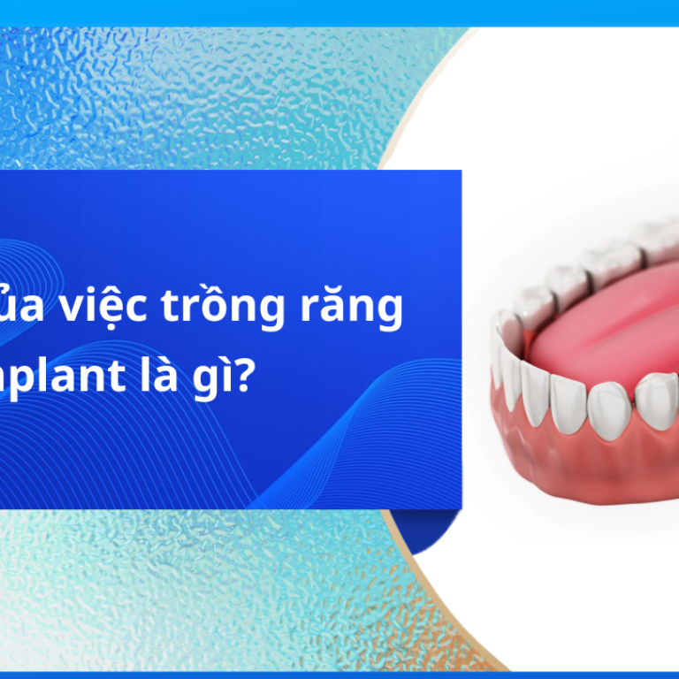 Tác hại của việc trồng răng Implant là gì?