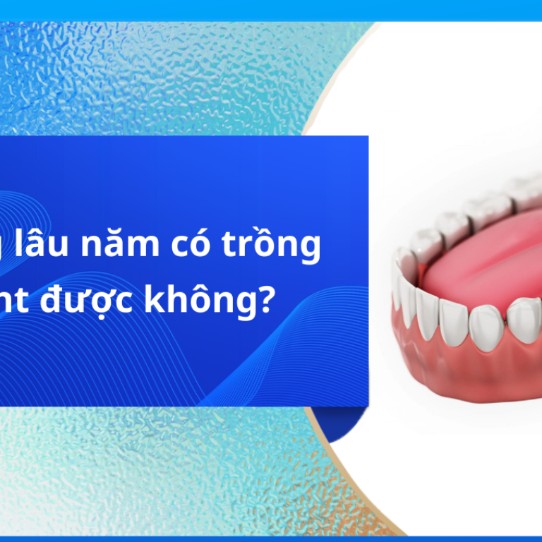 Mất răng lâu năm có trồng implant được không?