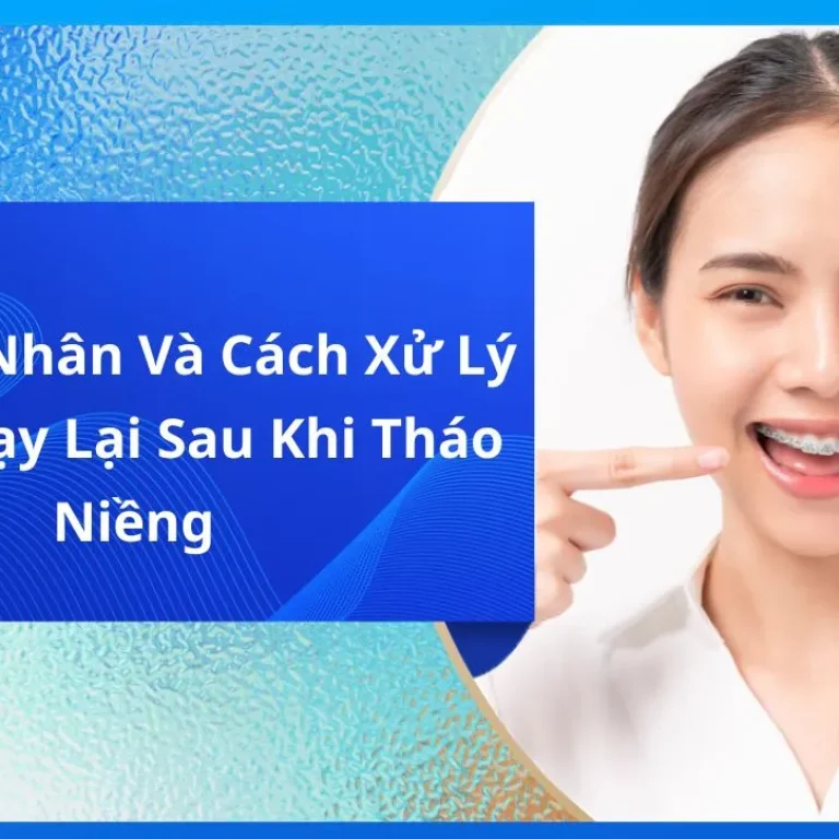 Nguyên Nhân Và Cách Xử Lý Răng Chạy Lại Sau Khi Tháo Niềng